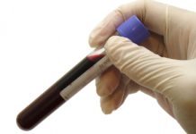 Blev utan blodförtunnande flera dagar