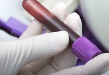 Nytt test kan förutsäga svar på antidepressiva