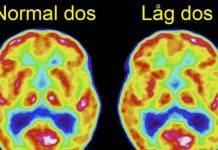 Stråldos kan halveras med ny forskning från Uppsala
