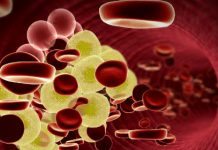 PCSK9-hämmare visar klinisk effekt