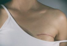 ”Gentest kan minska dödlighet i bröstcancer” Läkemedelsvärlden