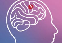 Framsteg i behandling av glioblastom