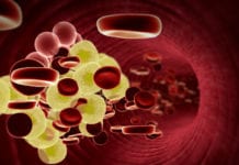 Nya riktlinjer för lipider kan ge stora kostnadsökningar Läkemedelsvärlden