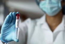 Läkemedelskandidater mot ebola testas i studie