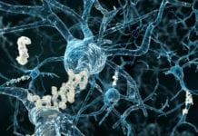 BAN 2401 testas som Alzheimerprevention Läkemedelsvärlden