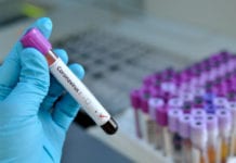 Roche uppmanar till mer återhållsam testning Läkemedelsvärlden