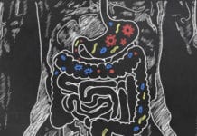 Nytt dödsfall efter fekal transplantation i USA Läkemedelsvärlden