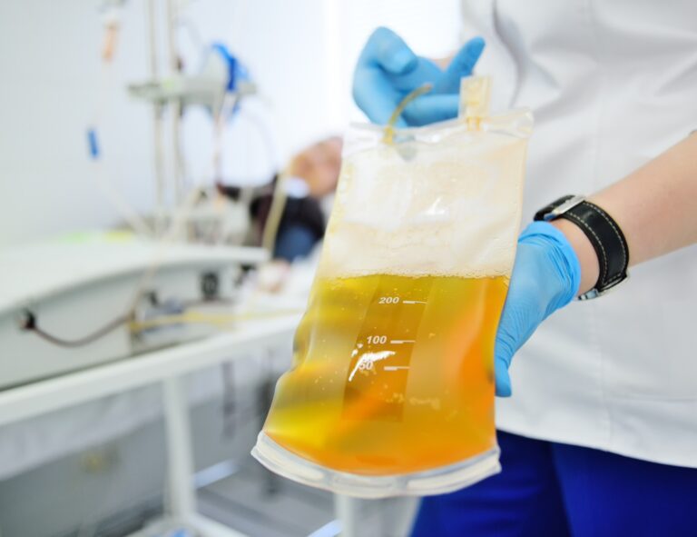 Kräver åtgärder för ökad tillgång på blodplasma