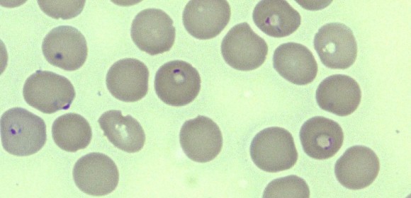 ”Vaccin är enda långsiktiga lösningen”