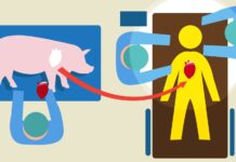 Organ från djur väcker svåra frågor