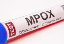 Antiviral terapi utan effekt mot mpox i fas III-studie