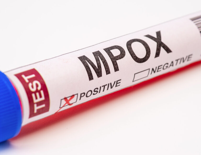 ECDC: Den farligare typen av mpox sprids nu i Europa