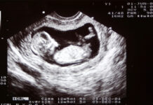 Tvååring ännu frisk efter behandling i livmodern Läkemedelsvärlden